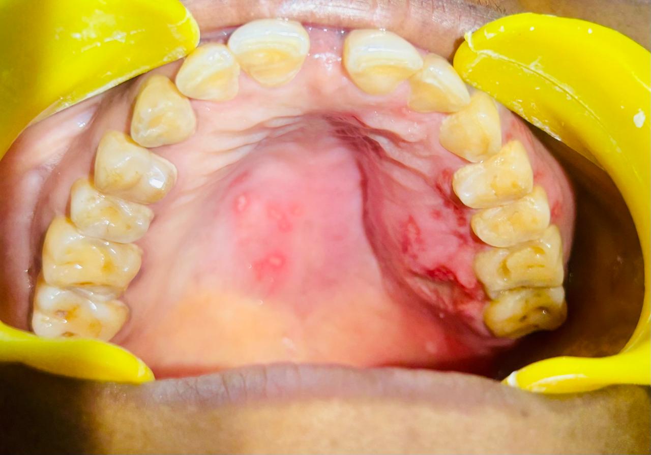 Oral cancer and disease examination